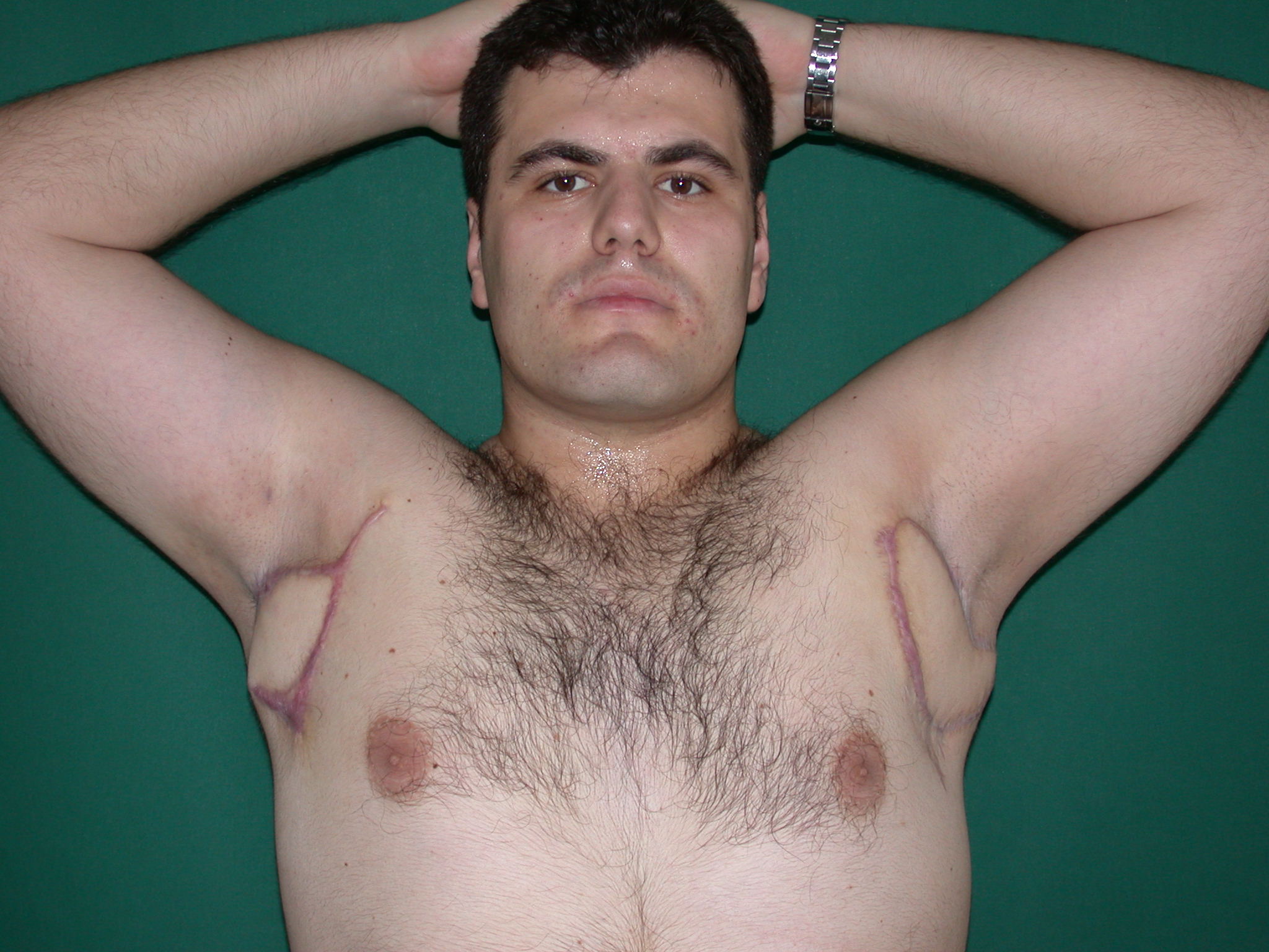 мужская грудь с сосками фото 103