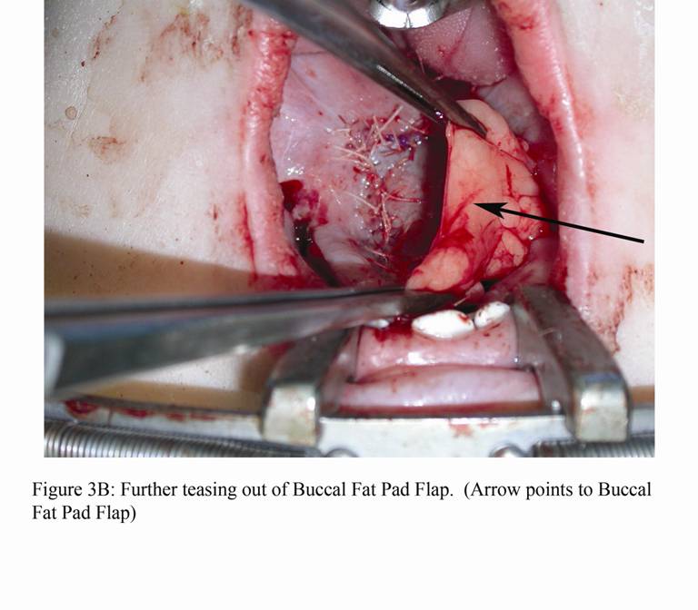 figure3Bteasing out BFP copy.jpg