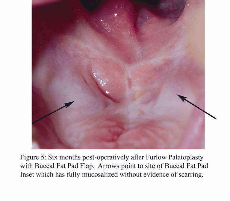 figure 5 copy.jpg